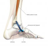 calcaneonavicular-li.jpg